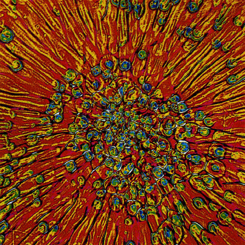 C21 - Cytoplasmic painting by surface forces